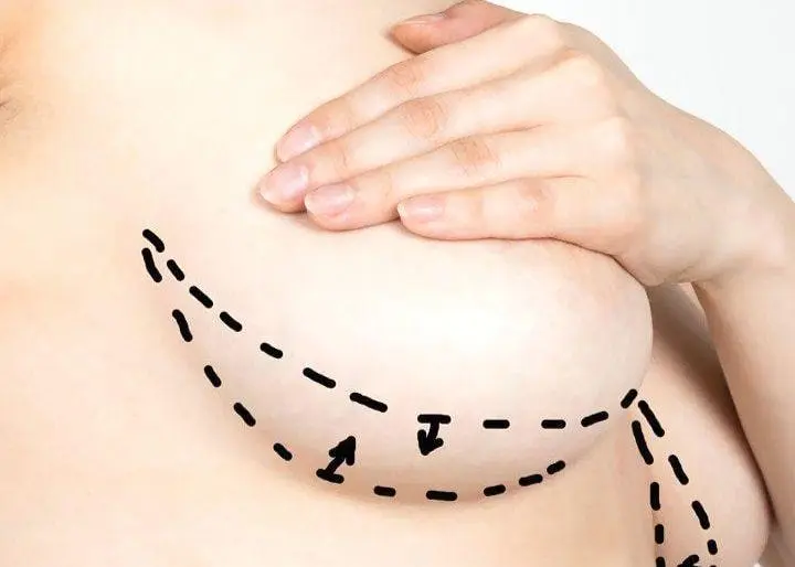 تكلفة عملية تصغير الصدرفي الرياض