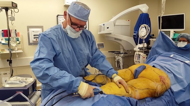 تجربتي مع عملية شفط الدهون في الرياض 1 تجربتي مع شفط الدهون بالفيزر وكيف توصلت إلى أنني بحاجة لإجراءها