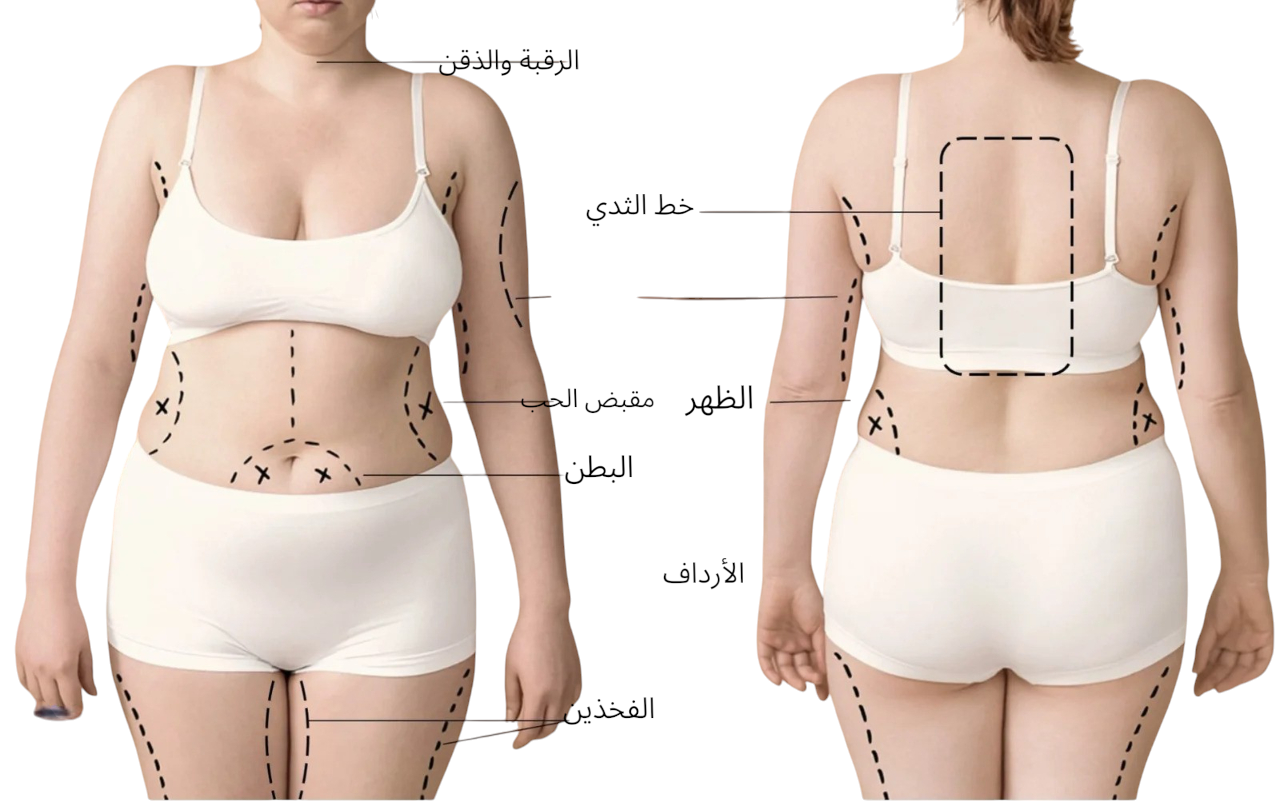 تجربتي مع عملية شفط الدهون في الرياض 14 ما هي أجزاء الجسم التي يمكن شفط الدهون منها؟-Photoroom (1)