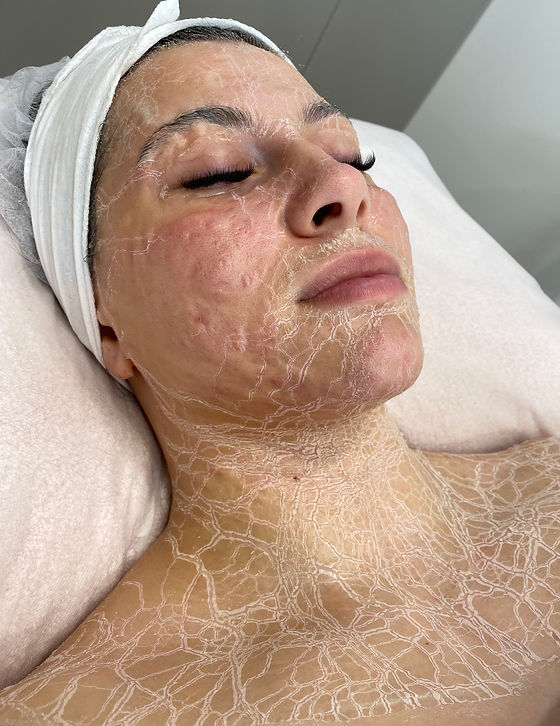 العلاج الإنزيمي دي إم كيه في الرياض 2 dmk enzyme therapy procedure