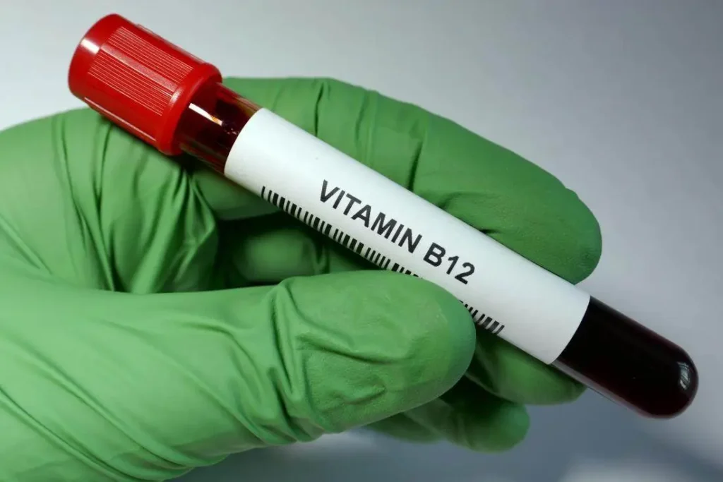 تحليل فيتامين ب12 المنزلي في الرياض 1 vitamin b12 procedure 1024x683 1