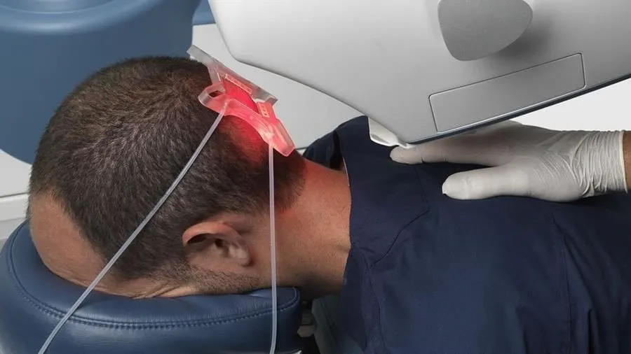 تكلفة زراعة الشعر بالروبوت في الرياض