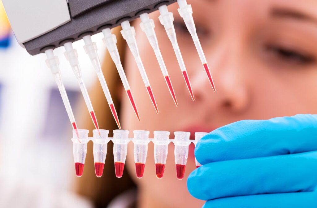 العلاج بالخلايا الجذعية في الرياض