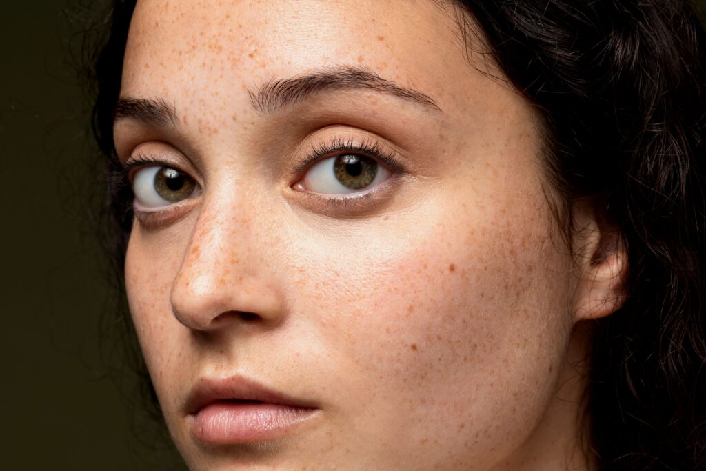 خطوات علاج تصبغ الجلد