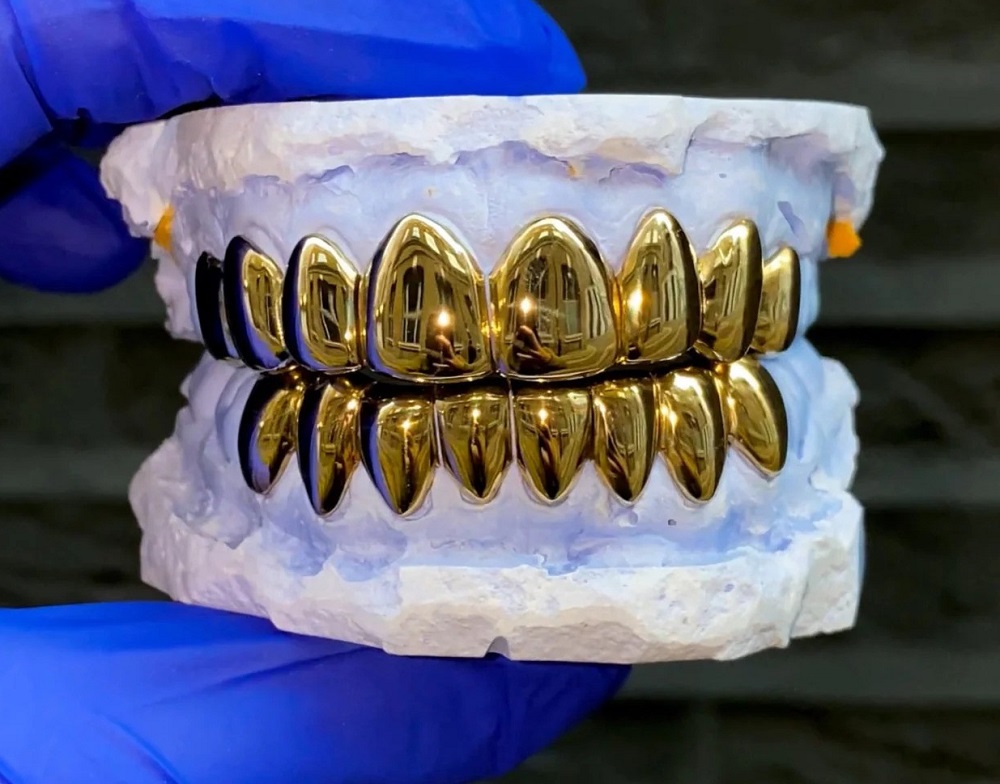 أسنان ذهبية في الرياض