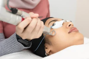 سعر ليزر كيو-سويتش في الدمام