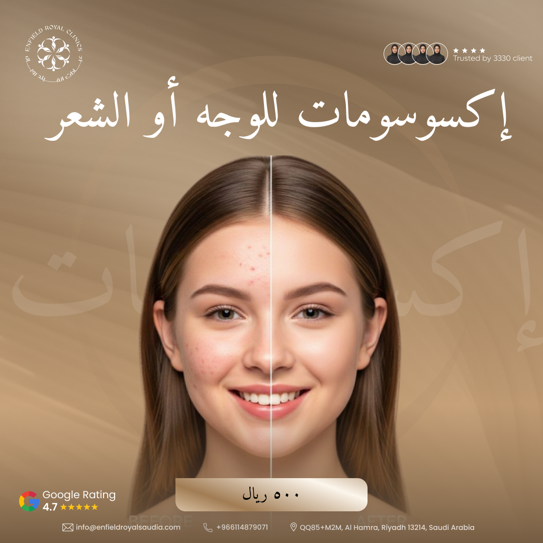 Exosomes face or Hair 1