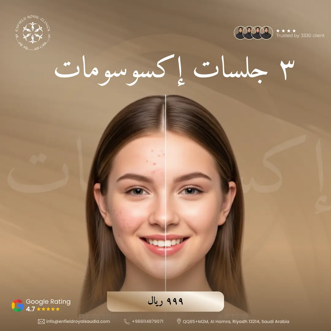 3 جلسات إكسوسومات