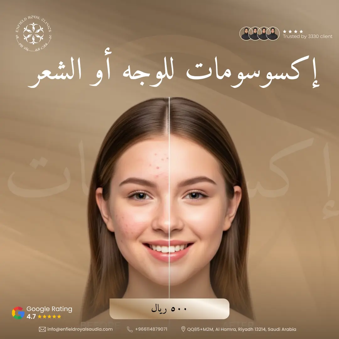 إكسوسومات للوجه أو الشعر