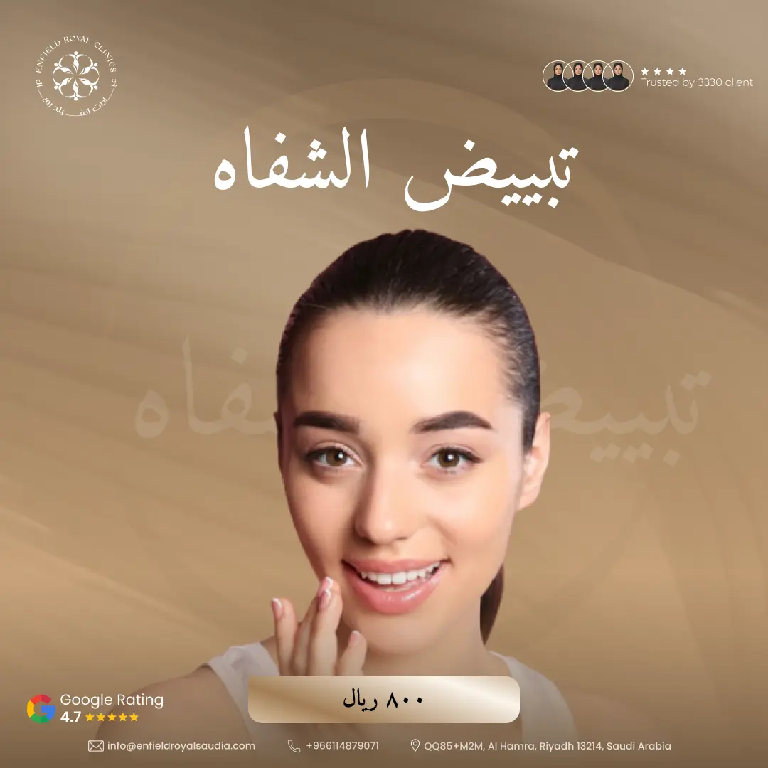 تبييض الشفاه