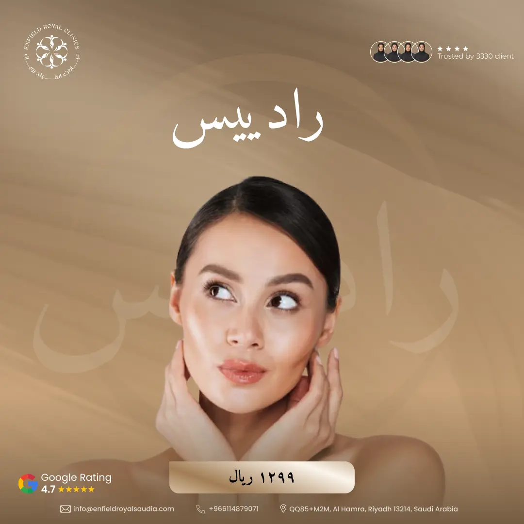 راديس