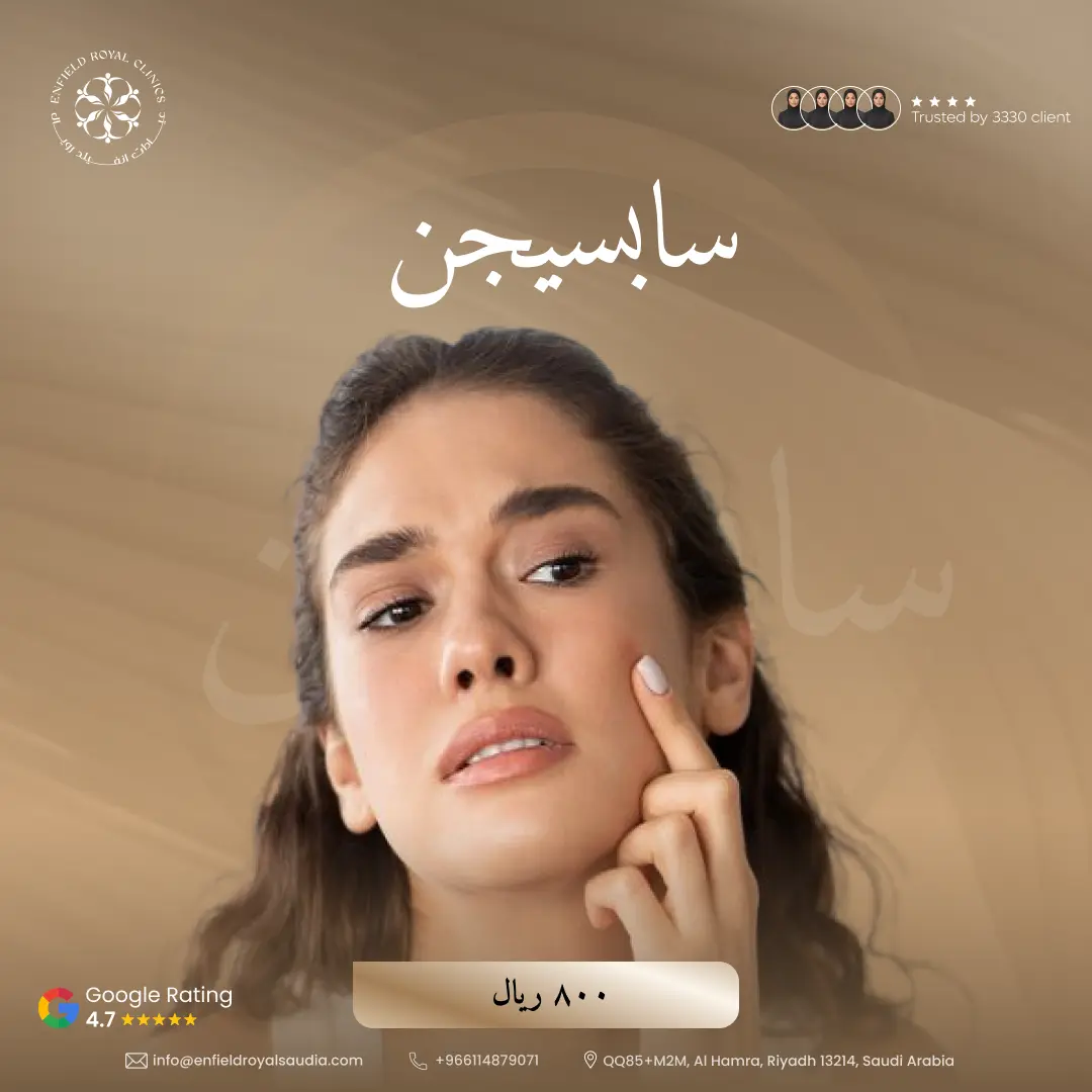 سابسيجن