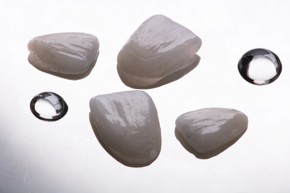 E-Max Veneers in Riyadh | Saudi Arabia 1 E Max Veneers how it works