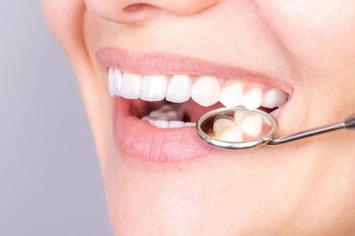 E-Max Crowns in Riyadh | Saudi Arabia 3 ceramic crowns results