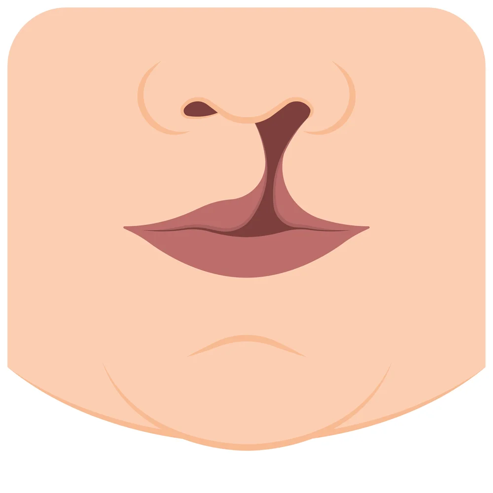 Palate Repair Surgery 1 cleft lip surgery how it works