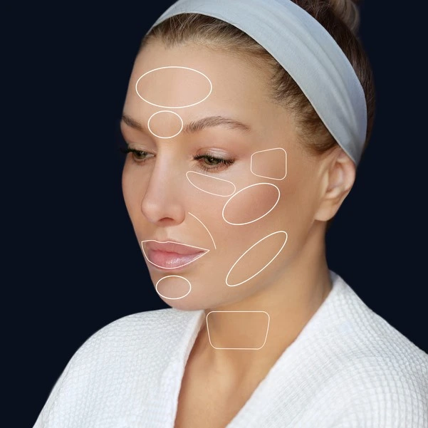 Voluma Filler in Riyadh, Saudi Arabia 2 dermal fillers in saudi arabia