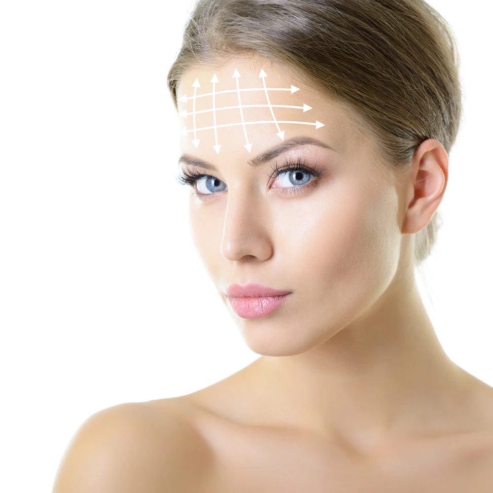 Forehead Lift in Riyadh 1 forehead lift how it works