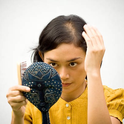 GFC Hair Treatment in Riyadh 4 hair fillers for baldness in saudi arabia