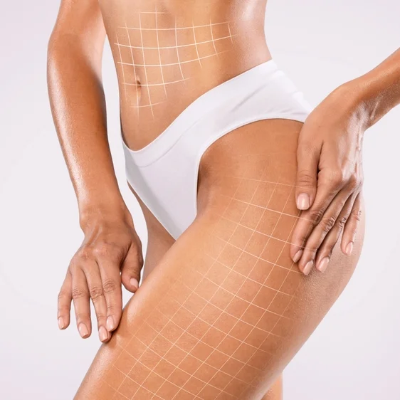 Lower Body Lift in Riyadh 3 lower body lift results