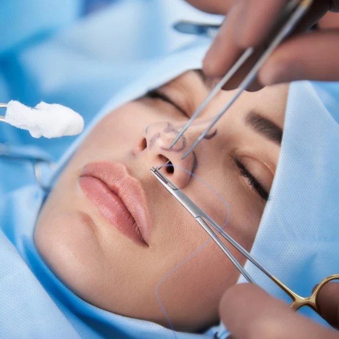 Alarplasty 2 rhinoplasty procedure