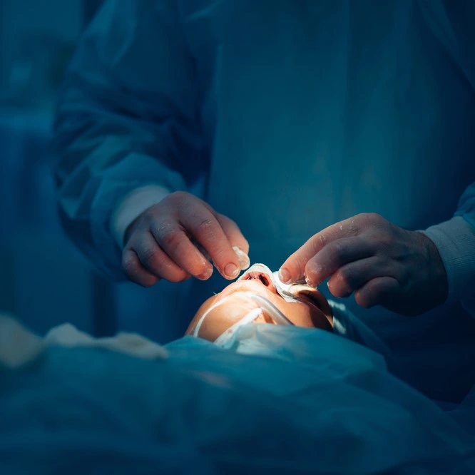 Septoplasty and Turbinate Reduction 2 septoplasty procedure