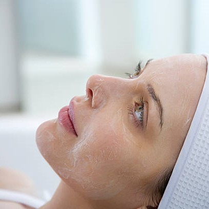 PCA Peel in Riyadh 4 Superficial chemical peel in saudi arabia