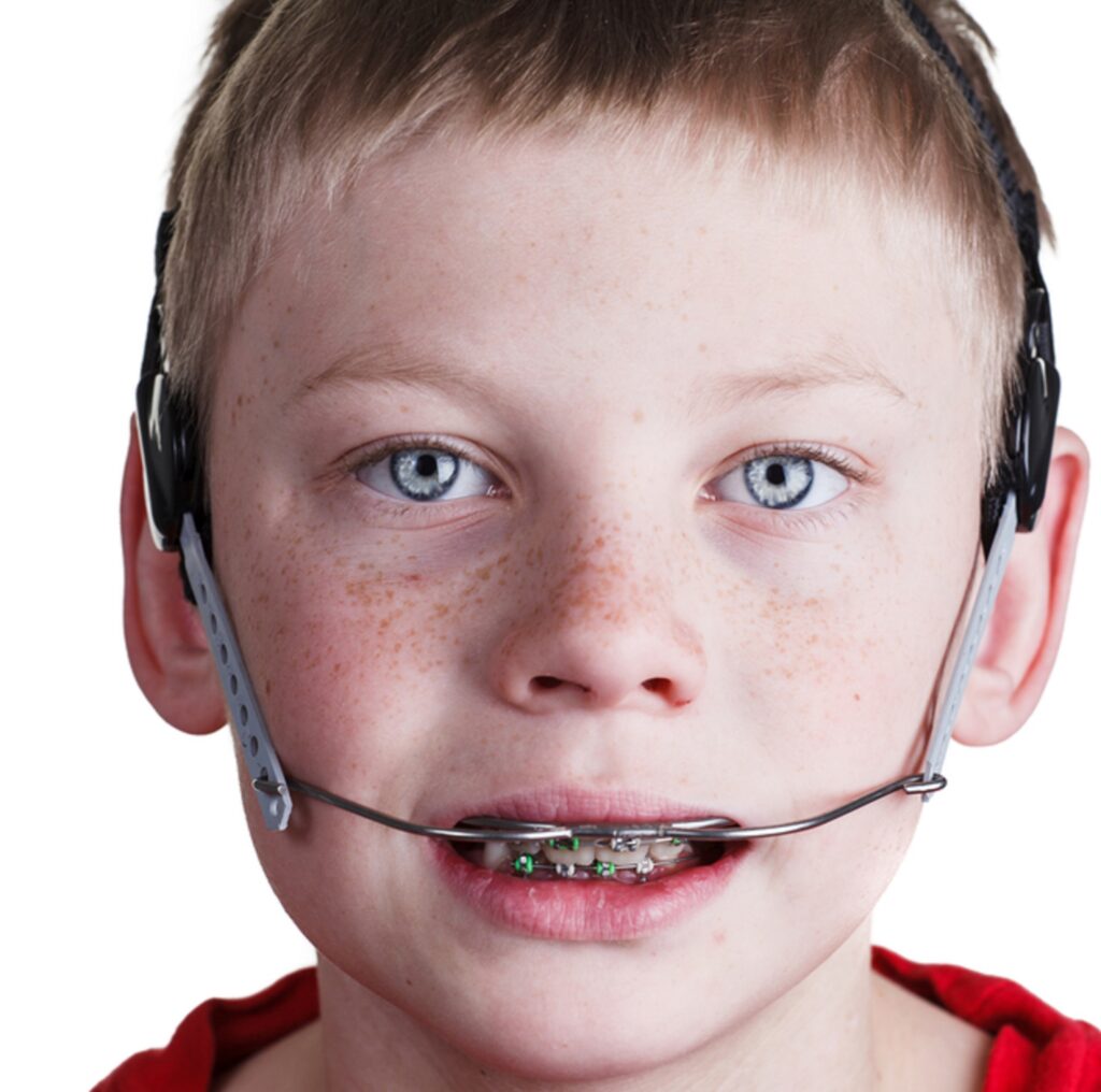 Dental Headgear in Riyadh, Saudi Arabia