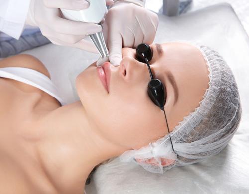 Smoker’s Lips Treatment 2 smokers lips treatment procedure