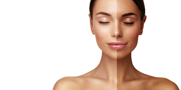Tan Removal 3 tan removal before and after