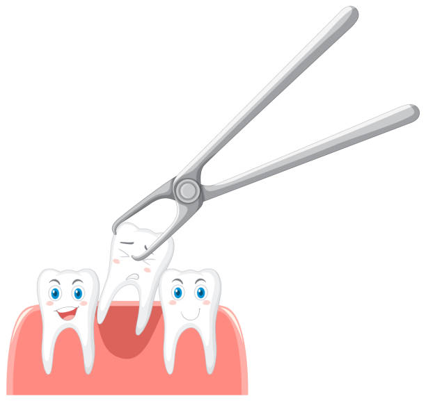 Dental Extraction 2 Dental Extraction how it works