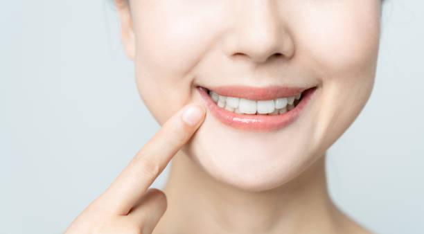 Gingivitis Treatment result