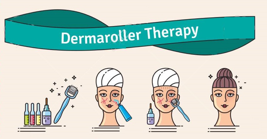 Derma Rollers Treatment 1 derma roller how does it work