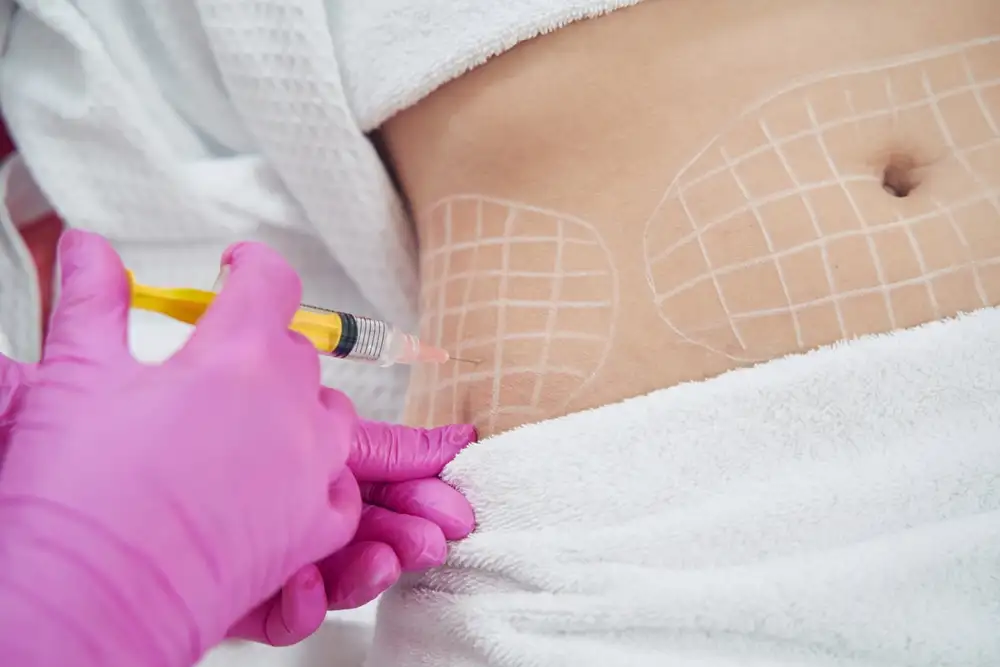 GPS Laser Liposuction in Riyadh 3 fat melting injections in riyadh