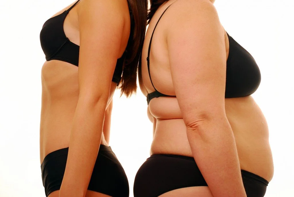 Obesity Treatment in Riyadh 2 Obesity treatment in Riyadh