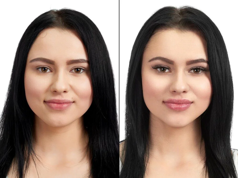 Amber Needle before after results in Riyadh