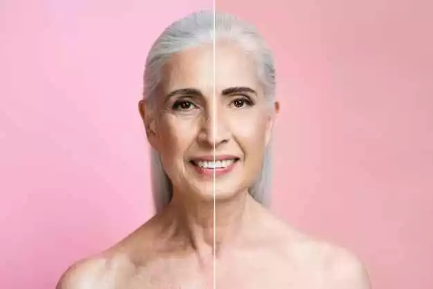 anti aging treatment before after in riyadh