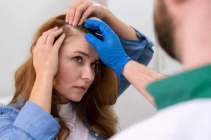 Hair Fillers For Baldness Cost in Riyadh