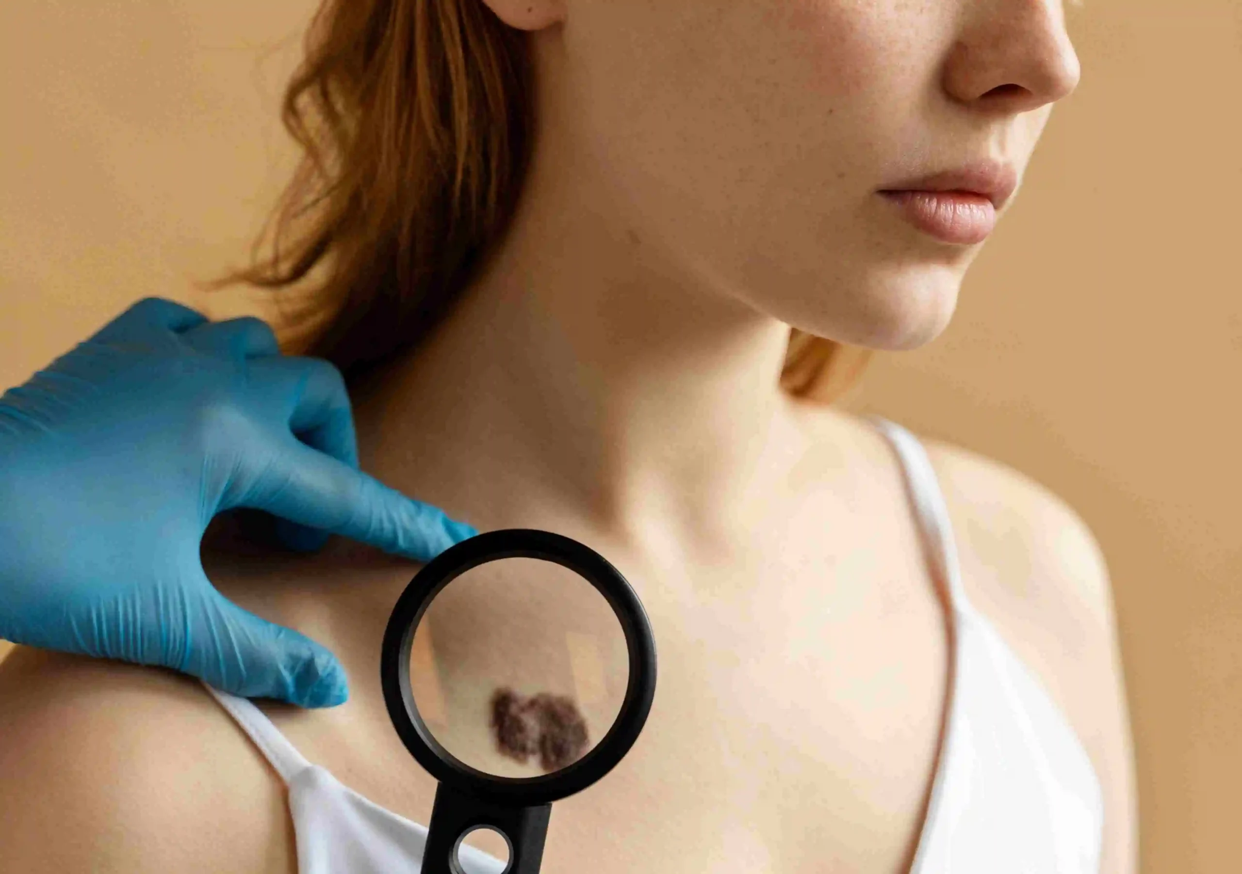 Warts Removal Cost in Riyadh
