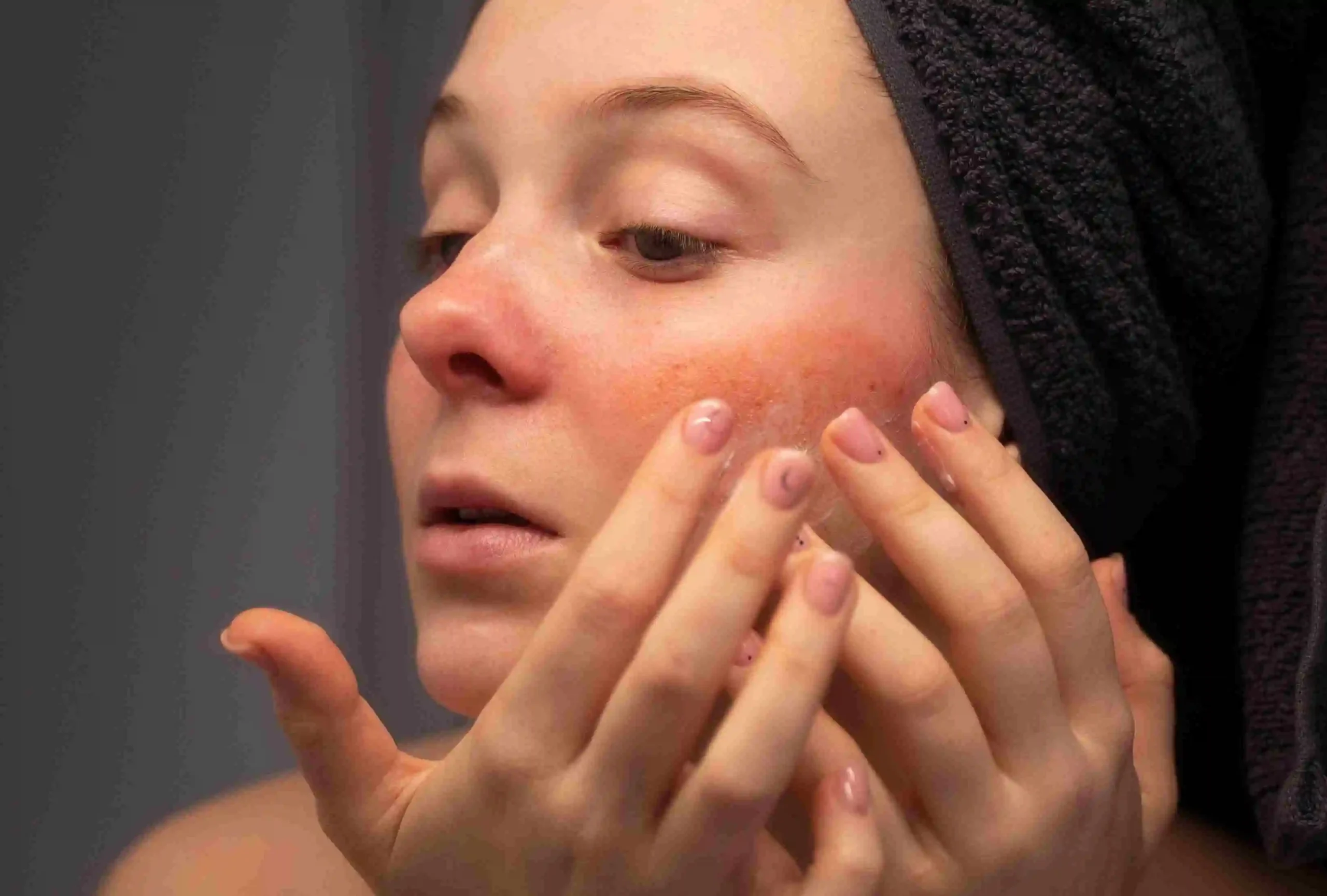 IPL for rosacea in Riyadh price
