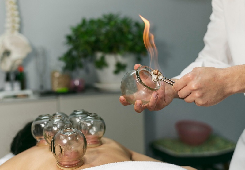Hijama For Hypertension in Riyadh