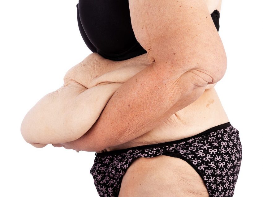 Gastric Bypass Surgery in Riyadh 1 gastric band surgery in riyadh