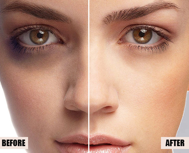 dark criels before after