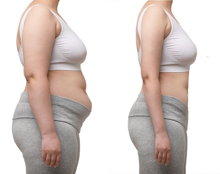 6 week belly ozempic weight loss before and after