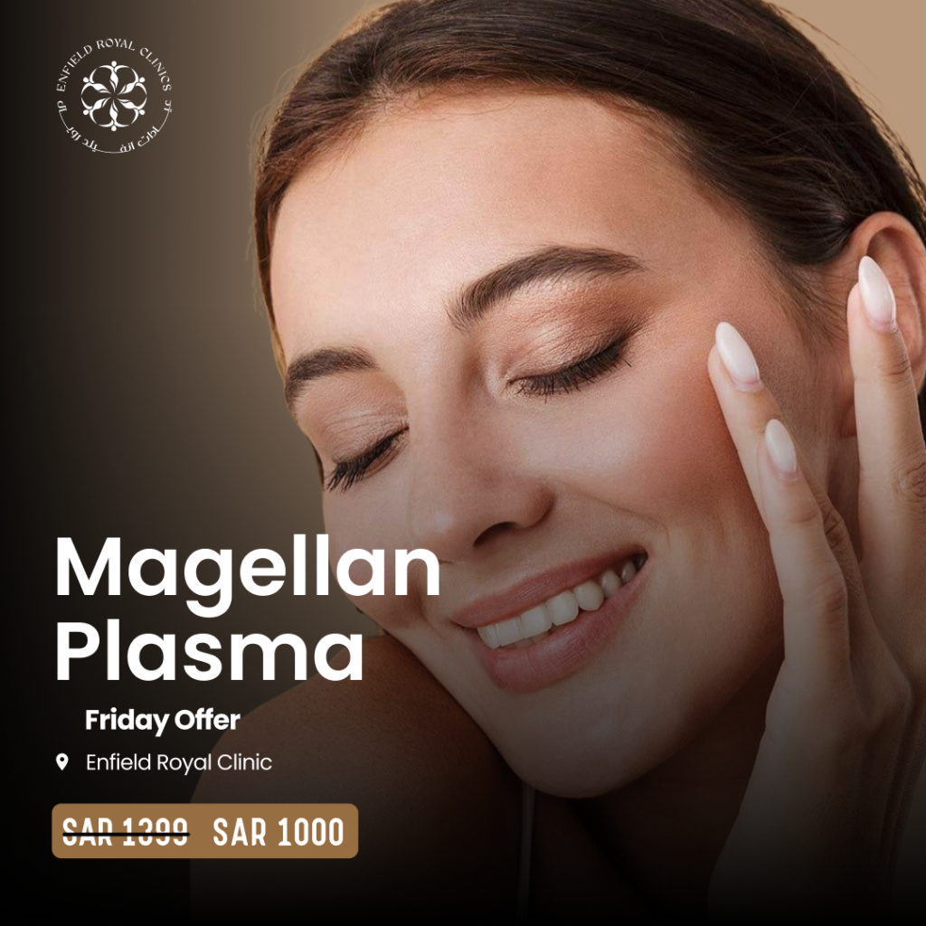 Magellan Plasma