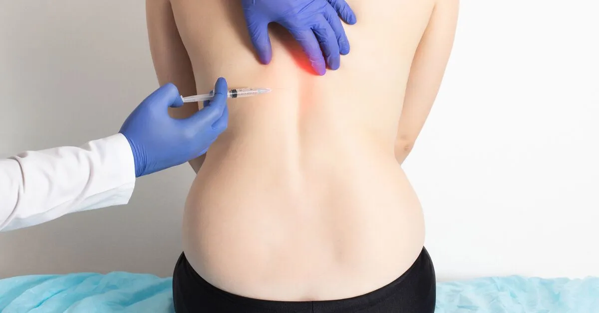 PRP for Back Pain in Riyadh 4 back pain procedure