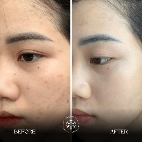 Gluta before and afte