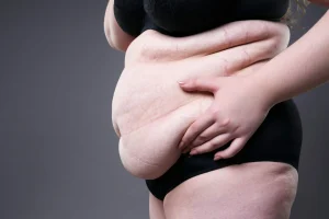 Laser Belly Fat Removal Cost in Dammam