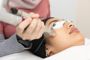 Q Switch Laser In Dammam Price