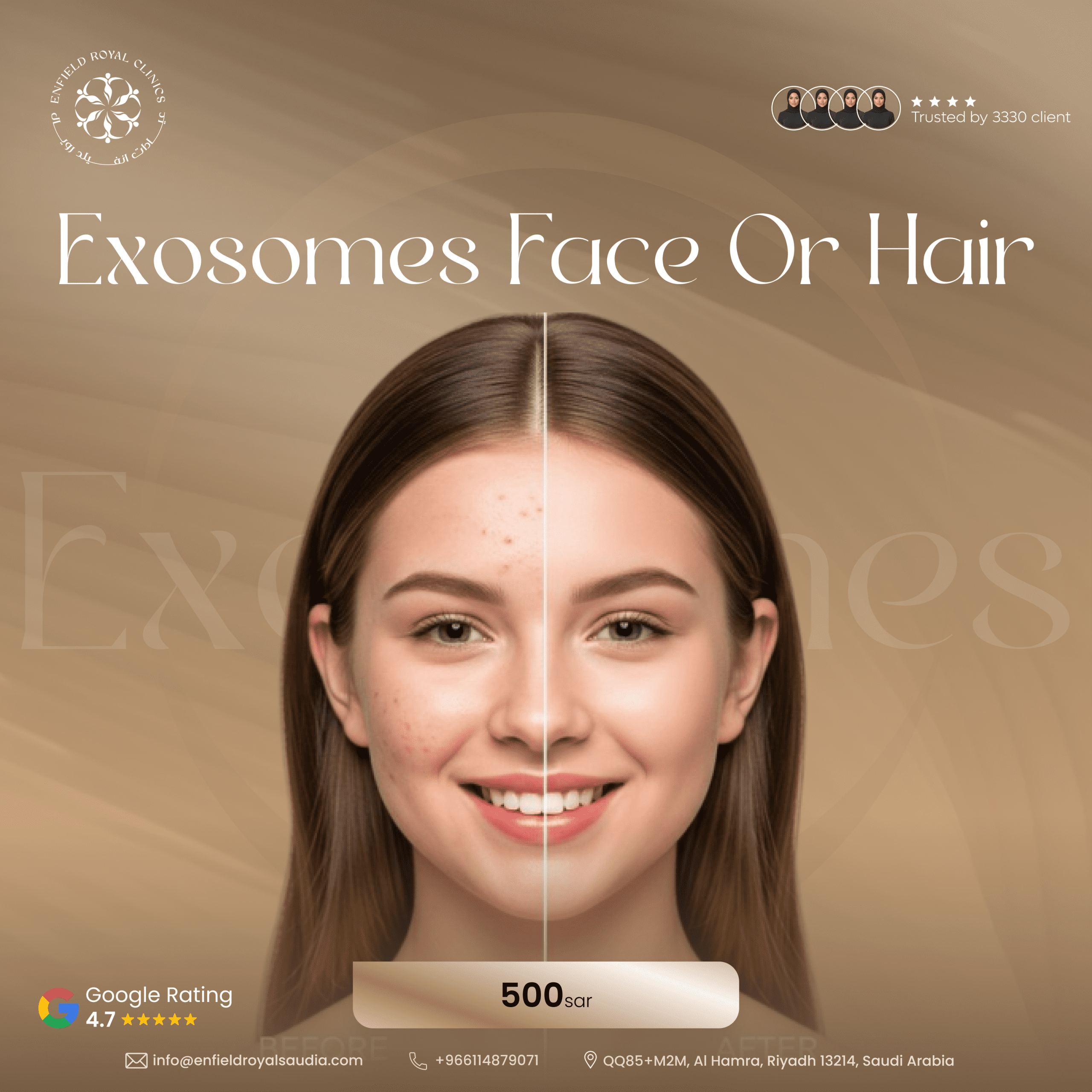 Exosomes face or Hair scaled
