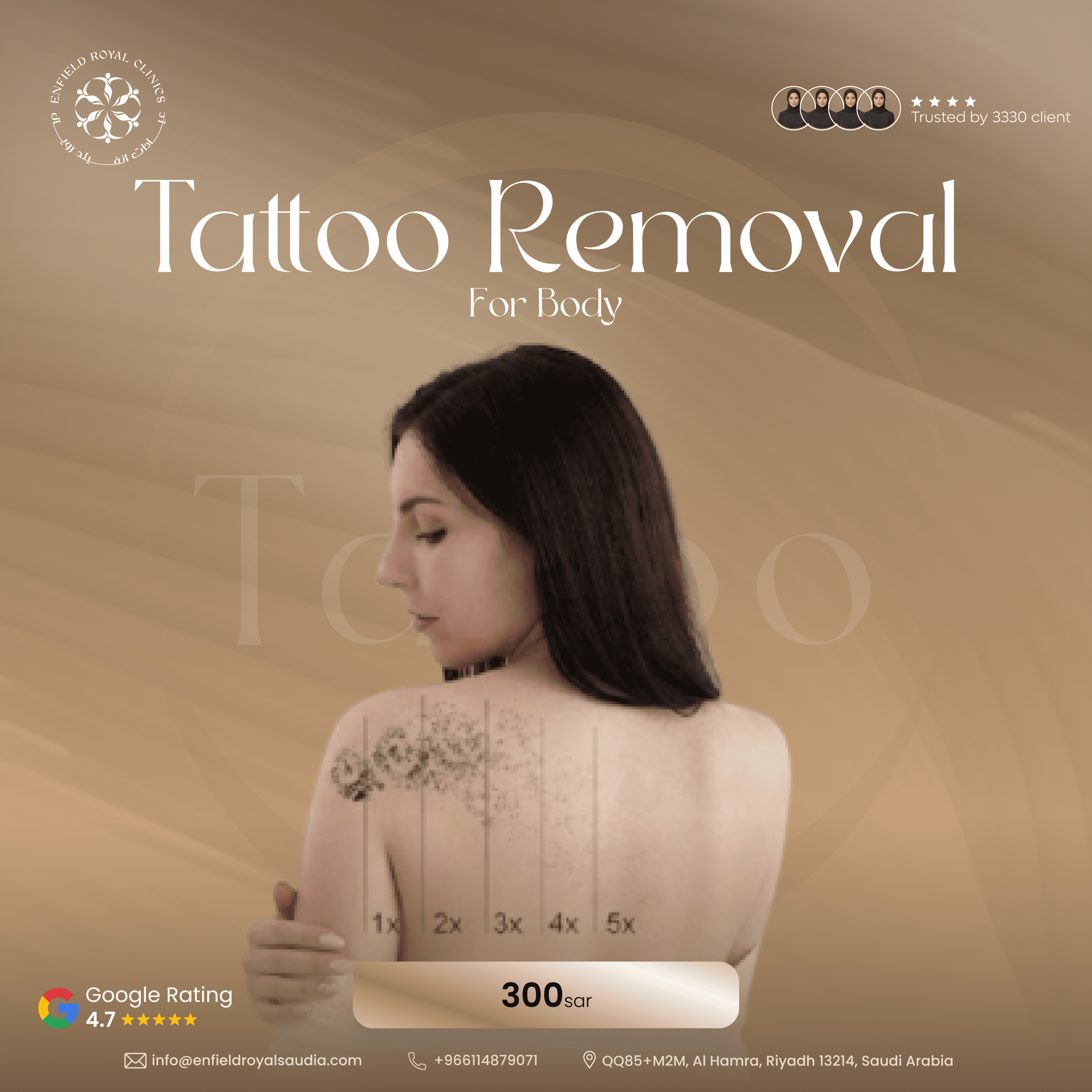 Tattoo Removal scaled
